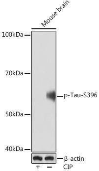 Anti-Phospho-Tau-S396 [ARC1573] Monoclonal Antibody (CABP1028)