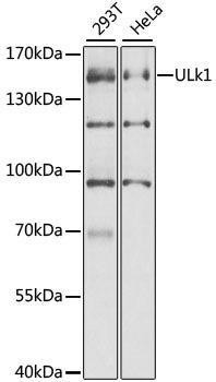 Anti-ULK1 Antibody (CAB8529)