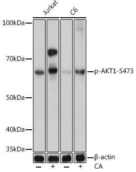 Anti-Phospho-AKT1-S473 [ARC0169] Monoclonal Antibody (CABP0637)