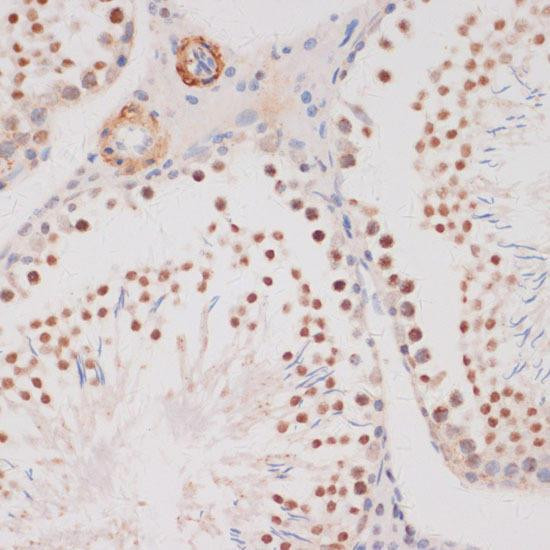 Anti-DDIT3/CHOP Antibody (CAB0221)