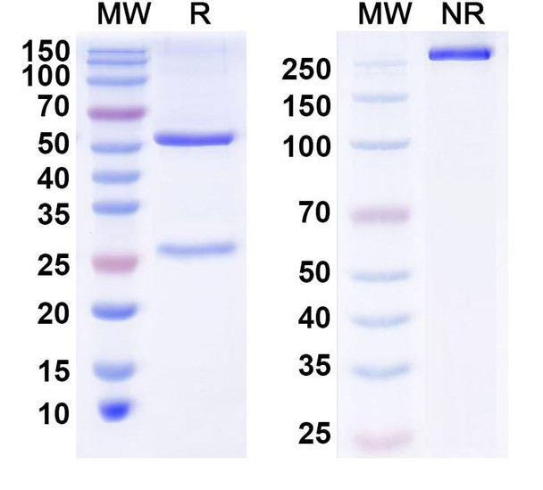 Anti-Siltuximab Non-Neutralizing Antibody [1A457]