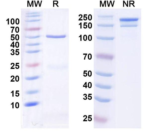 Anti-Siltuximab Neutralizing Antibody [1A456]