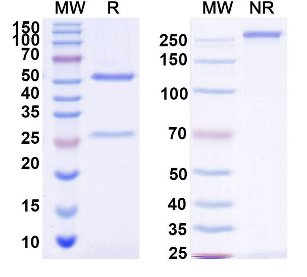 Anti-Siltuximab Neutralizing Antibody [1A455]