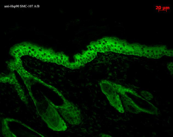 Immunohistochemistry analysis using Mouse Anti-Hsp90 Monoclonal Antibody, Clone H9010 (STMA00005). Tissue: backskin. Species: Mouse. Fixation: Bouin's Fixative and paraffin-embedded. Primary Antibody: Mouse Anti-Hsp90 Monoclonal Antibody (STMA00005) at 1:100 for 1 hour at RT. Secondary Antibody: FITC Goat Anti-Mouse (green) at 1:50 for 1 hour at RT. Localization: Epidermis.