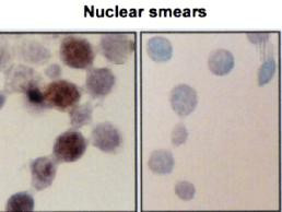 Immunocytochemistry/Immunofluorescence analysis using Mouse Anti-Hsp70 Monoclonal Antibody, Clone BB70 (STMA00004). Tissue: hepatocyte nuclei. Species: Rat. Primary Antibody: Mouse Anti-Hsp70 Monoclonal Antibody (STMA00004) at 1:200. Liver sections were paraffin embedded. First pictures in series show two hours after exposure to stress, the second shows the control. Courtesy of: G. Matic, University of Belgrade, Serbia.