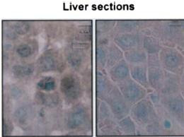 Immunohistochemistry analysis using Mouse Anti-Hsp70 Monoclonal Antibody, Clone BB70 (STMA00004). Tissue: hepatocytes. Species: Rat. Fixation: Paraffin Embedded. Primary Antibody: Mouse Anti-Hsp70 Monoclonal Antibody (STMA00004) at 1:200. Liver sections were paraffin embedded. First pictures in series show two hours after exposure to stress, the second shows the control. Courtesy of: G. Matic, University of Belgrade, Serbia.