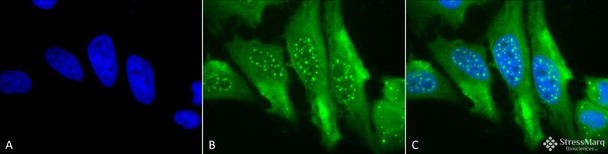 Immunocytochemistry/Immunofluorescence analysis using Mouse Anti-HO-1 Monoclonal Antibody, Clone 1F12-A6 (STMA00018). Tissue: Cervical cancer cell line (HeLa). Species: Human. Fixation: 2% Formaldehyde for 20 min at RT. Primary Antibody: Mouse Anti-HO-1 Monoclonal Antibody (STMA00018) at 1:100 for 12 hours at 4°C. Secondary Antibody: FITC Goat Anti-Mouse (green) at 1:200 for 2 hours at RT.