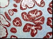 Immunohistochemistry analysis using Mouse Anti-FKBP52 Monoclonal Antibody, Clone Hi52C (STMA00022). Tissue: prostate tissue (ductal epithelial cells). Species: Human. Primary Antibody: Mouse Anti-FKBP52 Monoclonal Antibody (STMA00022) at 1:1000. Courtesy of: David F. Smith, Mayo Clinic, USA.