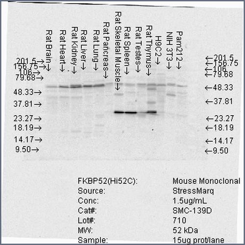 Western Blot analysis of Rat Brain, Heart, Kidney, Liver, Pancreas, Skeletal muscle, Spleen, Testes, Thymus cell lysates showing detection of FKBP52 protein using Mouse Anti-FKBP52 Monoclonal Antibody, Clone Hi52C (STMA00022). Load: 15 µg. Block: 1.5% BSA for 30 minutes at RT. Primary Antibody: Mouse Anti-FKBP52 Monoclonal Antibody (STMA00022) at 1.5 µg/mL for 2 hours at RT. Secondary Antibody: Sheep Anti-Mouse IgG: HRP for 1 hour at RT.