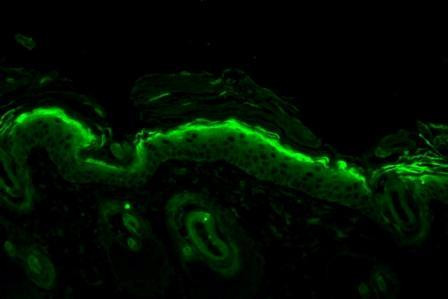 Immunohistochemistry analysis using Mouse Anti-Nitrotyrosine Monoclonal Antibody, Clone 39B6 (STMA00033). Tissue: backskin. Species: Mouse. Fixation: Bouin's Fixative and paraffin-embedded. Primary Antibody: Mouse Anti-Nitrotyrosine Monoclonal Antibody (STMA00033) at 1:100 for 1 hour at RT. Secondary Antibody: FITC Goat Anti-Mouse (green) at 1:50 for 1 hour at RT. Backskin obtained from transgenic mice.