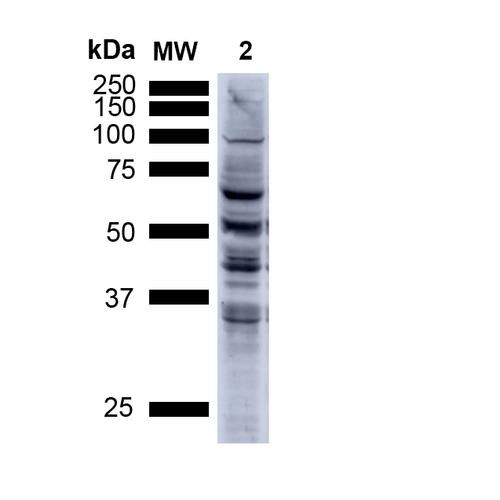 Western Blot analysis of Human A549 cells showing detection of Multiple Bands Nitrotyrosine protein using Mouse Anti-Nitrotyrosine Monoclonal Antibody, Clone 39B6 (STMA00033). Lane 1: MW ladder. Lane 2: Human A549 Cells 15 ug). Load: 15 ug. Block: 5% Skim Milk Powder in TBST. Primary Antibody: Mouse Anti-Nitrotyrosine Monoclonal Antibody (STMA00033) at 1:1000 for 2.5 hours at RT with shaking.