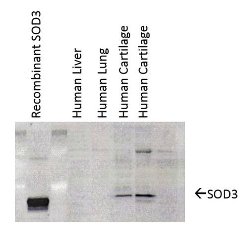 Western Blot analysis of Human cartilage lysates showing detection of SOD3 protein using Mouse Anti-SOD3 Monoclonal Antibody, Clone 4GG11G6 (STMA00041). Primary Antibody: Mouse Anti-SOD3 Monoclonal Antibody (STMA00041) at 1:1000. Left: Control, Middle: Young cartilage, Right: Cartilage sample with osteoarthritis-arthritis.