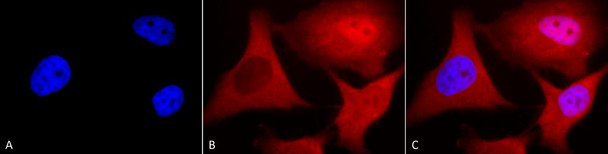 Immunocytochemistry/Immunofluorescence analysis using Mouse Anti-Ubiquitin Monoclonal Antibody, Clone 6C11-B3 (STMA00043). Tissue: Cervical cancer cell line (HeLa). Species: Human. Fixation: 2% Formaldehyde for 20 min at RT. Primary Antibody: Mouse Anti-Ubiquitin Monoclonal Antibody (STMA00043) at 1:100 for 12 hours at 4°C. Secondary Antibody: APC Goat Anti-Mouse (red) at 1:200 for 2 hours at RT.
