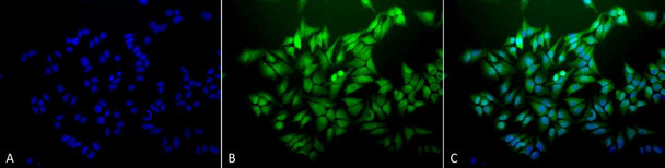 Immunocytochemistry/Immunofluorescence analysis using Mouse Anti-Ubiquitin Monoclonal Antibody, Clone 6C11-B3 (STMA00043). Tissue: Cervical cancer cell line (HeLa). Species: Human. Fixation: 2% Formaldehyde for 20 min at RT. Primary Antibody: Mouse Anti-Ubiquitin Monoclonal Antibody (STMA00043) at 1:100 for 12 hours at 4°C. Secondary Antibody: FITC Goat Anti-Mouse (green) at 1:200 for 2 hours at RT.