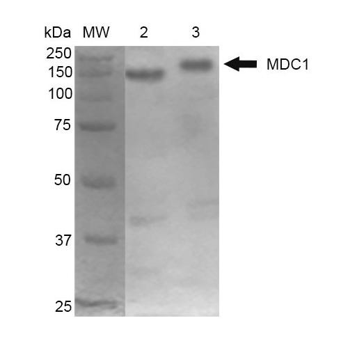 Western Blot analysis of Mouse Cortex and Cerebellum showing detection of 184 kDa MDC1 protein using Mouse Anti-MDC1 Monoclonal Antibody, Clone P2B11 (STMA00055). Lane 1: MW ladder. Lane 2: Mouse Cortex. Lane 3: Mouse Cerebellum. Load: 10 µg. Block: 5% Skim Milk in 1X TBST. Primary Antibody: Mouse Anti-MDC1 Monoclonal Antibody (STMA00055) at 1:1000 for 2 hours RT. Secondary Antibody: Goat Anti-Mouse at 1:2000 for 60 min at RT.