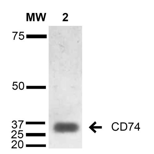 Western Blot analysis of Human Lymphoblastoid cell line (Raji) showing detection of 33-35 kDa CD74 protein using Mouse Anti-CD74 Monoclonal Antibody, Clone 1B8 (STMA00077). Lane 1: Molecular Weight Ladder (MW). Lane 2: Raji cell lysate. Load: 15 µg. Block: 5% Skim Milk in TBST. Primary Antibody: Mouse Anti-CD74 Monoclonal Antibody (STMA00077) at 1:1000 for 2 hours at RT. Secondary Antibody: Goat Anti-Mouse IgG: HRP at 1:1000 for 60 min at RT.