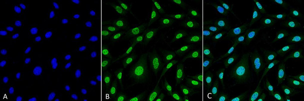 Immunocytochemistry/Immunofluorescence analysis using Mouse Anti-HO-1 (Rat) Monoclonal Antibody, Clone 6B8-2F2 (STMA00068). Tissue: Fibroblast cell line (NIH 3T3). Species: Mouse. Fixation: 4% Formaldehyde for 15 min at RT. Primary Antibody: Mouse Anti-HO-1 (Rat) Monoclonal Antibody (STMA00068) at 1:100 for 60 min at RT. Secondary Antibody: Goat Anti-Mouse ATTO 488 at 1:100 for 60 min at RT.