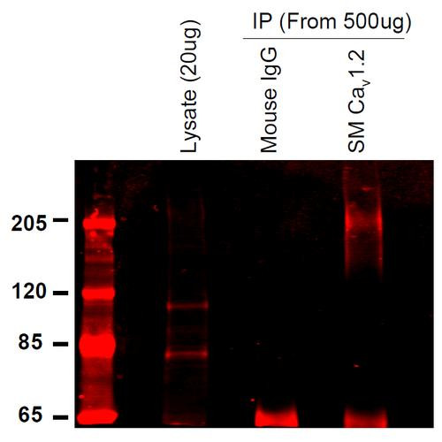 Immunoprecipitation analysis using Mouse Anti-CaV1.2 Calcium Channel Monoclonal Antibody, Clone S57 (STMA00080). Tissue: INS-1E cells. Species: Rat. Primary Antibody: Mouse Anti-CaV1.2 Calcium Channel Monoclonal Antibody (STMA00080) at 1:200. Courtesy of: Merrie Mosedale.
