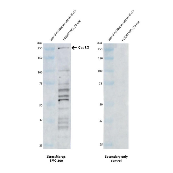 Western Blot analysis with Anti-Cav1.2 Antibody [S57] (STMA00080) showing detection of Cav1.2 in HEK293 whole cell lysate (Rockland W09-000-365) heated at 60°C for 10 minutes. Human Cav1.2 protein (UniProt Q13936) has a predicted molecular weight of ~249 kDa. Block: 2% skim milk + 2% BSA. Primary Antibody: Mouse Anti-Rabbit Cav1.2 Monoclonal IgG1 (STMA00080) at 1:1000 for 2 hours at RT.
