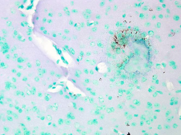 Immunohistochemistry analysis using Mouse Anti-CaV1.2 Calcium channel Monoclonal Antibody, Clone S57 (STMA00080). Tissue: Brain Tissue. Species: Mouse. Fixation: Formalin. Primary Antibody: Mouse Anti-CaV1.2 Calcium channel Monoclonal Antibody (STMA00080) at 1:10000 for 12 hours at 4°C. Secondary Antibody: Biotin Goat Anti-Mouse at 1:2000 for 1 hour at RT. Counterstain: Mayer Hematoxylin (purple/blue) nuclear stain at 200 µl for 2 minutes at RT.