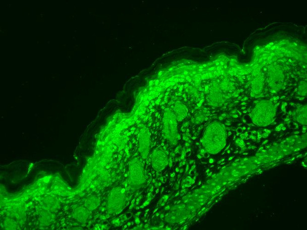 Immunohistochemistry analysis using Mouse Anti-CaV1.3 Calcium Channel Monoclonal Antibody, Clone S48 (STMA00081). Tissue: backskin. Species: Mouse. Fixation: Bouin's Fixative and paraffin-embedded. Primary Antibody: Mouse Anti-CaV1.3 Calcium Channel Monoclonal Antibody (STMA00081) at 1:100 for 1 hour at RT. Secondary Antibody: FITC Goat Anti-Mouse (green) at 1:50 for 1 hour at RT.