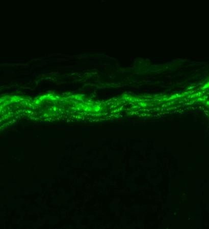Immunohistochemistry analysis using Mouse Anti-Nav1.7 Sodium Channel Monoclonal Antibody, Clone N68/6 (STMA00088). Tissue: backskin. Species: Mouse. Fixation: Bouin's Fixative and paraffin-embedded. Primary Antibody: Mouse Anti-Nav1.7 Sodium Channel Monoclonal Antibody (STMA00088) at 1:100 for 1 hour at RT. Secondary Antibody: FITC Goat Anti-Mouse (green) at 1:50 for 1 hour at RT.