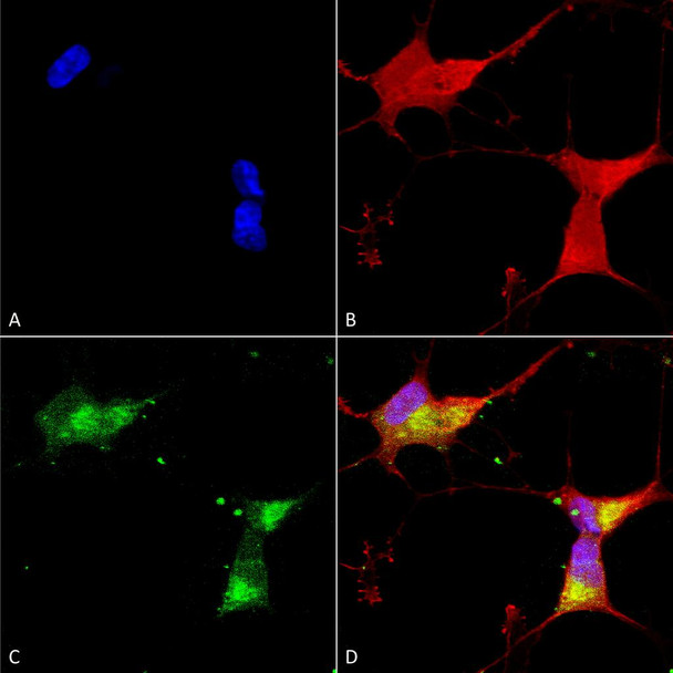 Immunocytochemistry/Immunofluorescence analysis using Mouse Anti-Kir2.1 Monoclonal Antibody, Clone S112 (STMA00087). Tissue: Neuroblastoma cells (SH-SY5Y). Species: Human. Fixation: 4% PFA for 15 min. Primary Antibody: Mouse Anti-Kir2.1 Monoclonal Antibody (STMA00087) at 1:50 for overnight at 4°C with slow rocking. Secondary Antibody: AlexaFluor 488 at 1:1000 for 1 hour at RT.