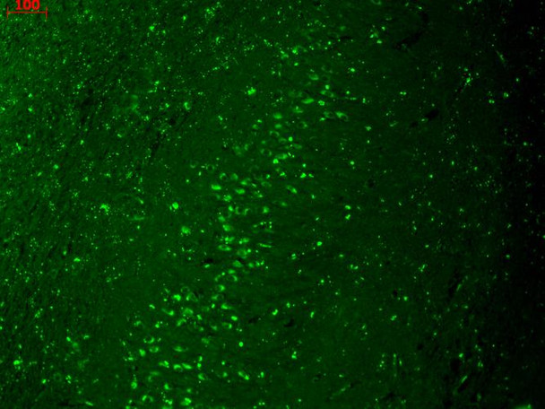 Immunohistochemistry analysis using Mouse Anti-Kir2.1 Potassium Channel Monoclonal Antibody, Clone S112 (STMA00087). Tissue: hippocampus. Species: Human. Fixation: Bouin's Fixative and paraffin-embedded. Primary Antibody: Mouse Anti-Kir2.1 Potassium Channel Monoclonal Antibody (STMA00087) at 1:1000 for 1 hour at RT. Secondary Antibody: FITC Goat Anti-Mouse (green) at 1:50 for 1 hour at RT.