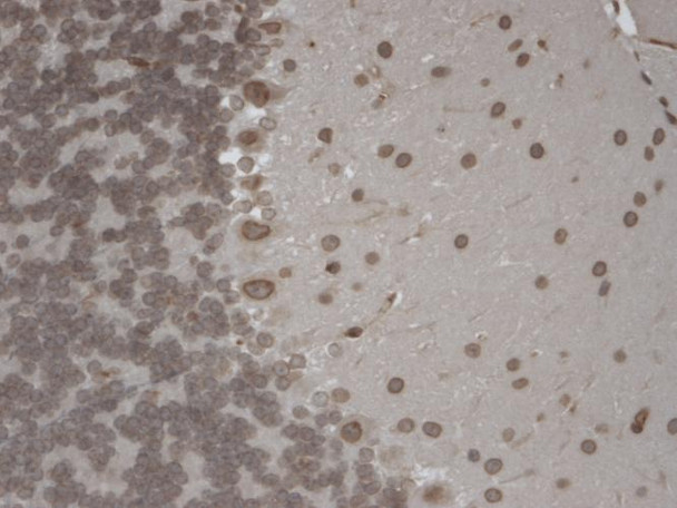 Immunohistochemistry analysis using Mouse Anti-TrpM7 Monoclonal Antibody, Clone S74 (STMA00089). Tissue: Brain Slice. Species: Mouse. Fixation: 10% Formalin Solution for 12-24 hours at RT. Primary Antibody: Mouse Anti-TrpM7 Monoclonal Antibody (STMA00089) at 1:1000 for 1 hour at RT. Secondary Antibody: HRP/DAB Detection System: Biotinylated Goat Anti-Mouse, Streptavidin Peroxidase, DAB Chromogen (brown) for 30 minutes at RT.