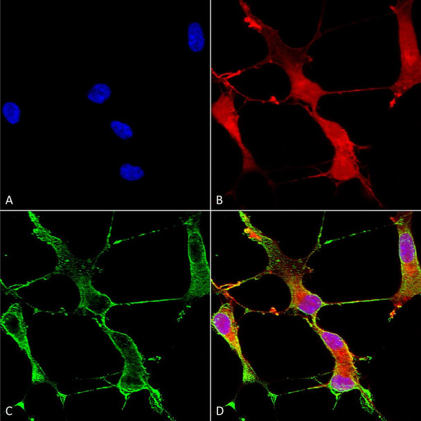 Immunocytochemistry/Immunofluorescence analysis using Mouse Anti-SHANK1 Monoclonal Antibody, Clone S22-21 (STMA00094). Tissue: Neuroblastoma cells (SH-SY5Y). Species: Human. Fixation: 4% PFA for 15 min. Primary Antibody: Mouse Anti-SHANK1 Monoclonal Antibody (STMA00094) at 1:50 for overnight at 4°C with slow rocking. Secondary Antibody: AlexaFluor 488 at 1:1000 for 1 hour at RT.