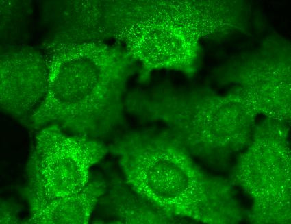 Immunocytochemistry/Immunofluorescence analysis using Mouse Anti-Cav Beta2 Calcium Channel Monoclonal Antibody, Clone S8b-1 (STMA00095). Tissue: HaCaT cells. Species: Human. Fixation: Cold 100% methanol for 10 minutes at -20°C. Primary Antibody: Mouse Anti-Cav Beta2 Calcium Channel Monoclonal Antibody (STMA00095) at 1:100 for 1 hour at RT. Secondary Antibody: FITC Goat Anti-Mouse (green) at 1:50 for 1 hour at RT.