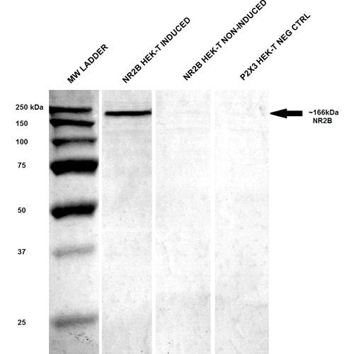 Western Blot analysis of Human Embryonic kidney epithelial cell line (HEK293T) lysate showing detection of GluN2B protein using Mouse Anti-GluN2B Monoclonal Antibody, Clone S59-36 (STMA00098). Primary Antibody: Mouse Anti-GluN2B Monoclonal Antibody (STMA00098) at 1:250.