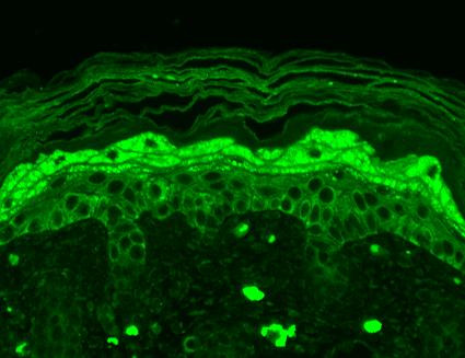 Immunohistochemistry analysis using Mouse Anti-GluN2B Monoclonal Antibody, Clone S59-36 (STMA00098). Tissue: backskin. Species: Mouse. Fixation: Bouin's Fixative and paraffin-embedded. Primary Antibody: Mouse Anti-GluN2B Monoclonal Antibody (STMA00098) at 1:100 for 1 hour at RT. Secondary Antibody: FITC Goat Anti-Mouse (green) at 1:50 for 1 hour at RT. Localization: Filaggrin-like staining, and dermal staining.