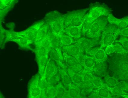 Immunocytochemistry/Immunofluorescence analysis using Mouse Anti-Nav1.8 Monoclonal Antibody, Clone S134 (STMA00100). Tissue: HaCaT cells. Species: Human. Fixation: Cold 100% methanol for 10 minutes at -20°C. Primary Antibody: Mouse Anti-Nav1.8 Monoclonal Antibody (STMA00100) at 1:100 for 1 hour at RT. Secondary Antibody: FITC Goat Anti-Mouse (green) at 1:50 for 1 hour at RT. Localization: Cytoplasmic staining and some dull nuclear staining.