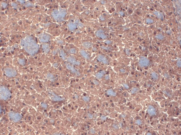 Immunohistochemistry analysis using Mouse Anti-GABA A Receptor Monoclonal Antibody, Clone N87/25 (STMA00099). Tissue: Brain. Species: mouse. Fixation: 10% Formalin Solution for 12-24 hours at RT. Primary Antibody: Mouse Anti-GABA A Receptor Monoclonal Antibody (STMA00099) at 1:1000 for 1 hour at RT. Secondary Antibody: HRP/DAB Detection System: Biotinylated Goat Anti-Mouse, Streptavidin Peroxidase, DAB Chromogen (brown) for 30 minutes at RT.