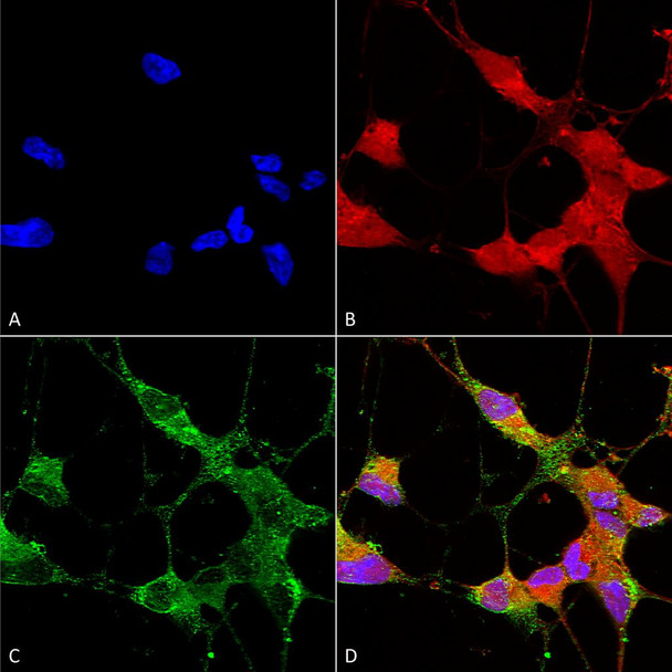 Immunocytochemistry/Immunofluorescence analysis using Mouse Anti-TrpC5 Monoclonal Antibody, Clone N67/15 (STMA00102). Tissue: Neuroblastoma cells (SH-SY5Y). Species: Human. Fixation: 4% PFA for 15 min. Primary Antibody: Mouse Anti-TrpC5 Monoclonal Antibody (STMA00102) at 1:50 for overnight at 4°C with slow rocking. Secondary Antibody: AlexaFluor 488 at 1:1000 for 1 hour at RT.
