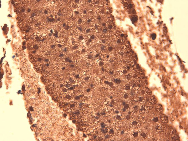 Immunohistochemistry analysis using Mouse Anti-Sodium Iodide Symporter Monoclonal Antibody, Clone 14F (STMA00105). Tissue: Thyroid. Species: Mouse. Fixation: 10% Formalin Solution for 12-24 hours at RT. Primary Antibody: Mouse Anti-Sodium Iodide Symporter Monoclonal Antibody (STMA00105) at 1:1000 for 1 hour at RT.