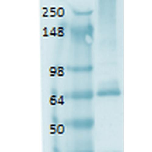 Western Blot analysis of Human thyroid lysate showing detection of Sodium Iodide Symporter protein using Mouse Anti-Sodium Iodide Symporter Monoclonal Antibody, Clone 14F (STMA00105). Primary Antibody: Mouse Anti-Sodium Iodide Symporter Monoclonal Antibody (STMA00105) at 1:1000.