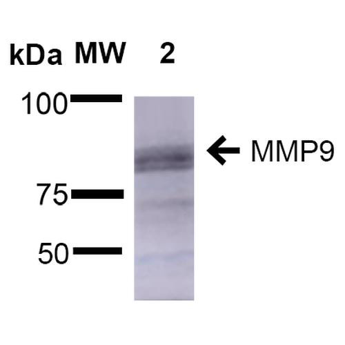 Western Blot analysis of Rat Brain showing detection of ~92 kDa and ~82 kDa (pro and active) MMP9 protein using Mouse Anti-MMP9 Monoclonal Antibody, Clone L51/82 (STMA00111). Lane 1: Molecular Weight Ladder (MW). Lane 2: Rat Brain. Load: 15 µg. Block: 5% Skim Milk in 1X TBST. Primary Antibody: Mouse Anti-MMP9 Monoclonal Antibody (STMA00111) at 1:1000 for 2 hours at RT. Secondary Antibody: Goat Anti-Mouse IgG: HRP at 1:2000 for 60 min at RT.