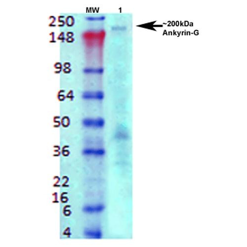 Western Blot analysis of Rat brain membrane lysate showing detection of Ankyrin G protein using Mouse Anti-Ankyrin G Monoclonal Antibody, Clone N106/20 (STMA00119). Primary Antibody: Mouse Anti-Ankyrin G Monoclonal Antibody (STMA00119) at 1:1000.