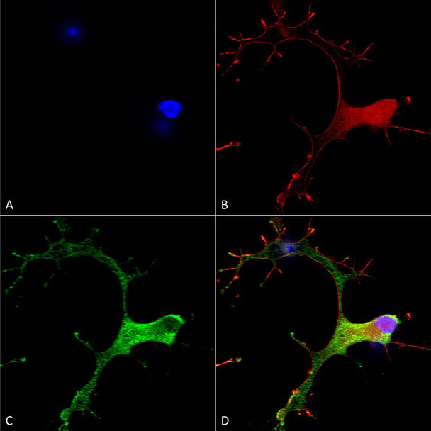 Immunocytochemistry/Immunofluorescence analysis using Mouse Anti-GABA-B Receptor 1 Monoclonal Antibody, Clone N93A/49 (STMA00118). Tissue: Neuroblastoma cells (SH-SY5Y). Species: Human. Fixation: 4% PFA for 15 min. Primary Antibody: Mouse Anti-GABA-B Receptor 1 Monoclonal Antibody (STMA00118) at 1:50 for overnight at 4°C with slow rocking. Secondary Antibody: AlexaFluor 488 at 1:1000 for 1 hour at RT.