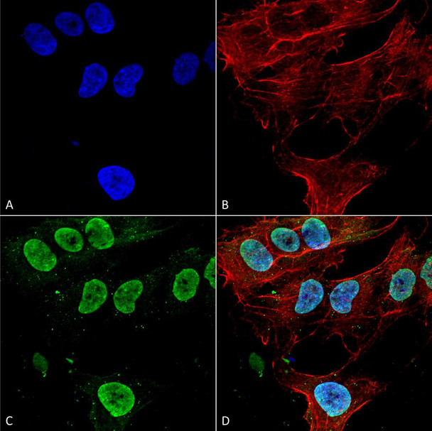 Immunocytochemistry/Immunofluorescence analysis using Mouse Anti-Cav3.1 Monoclonal Antibody, Clone N178A/9 (STMA00120). Tissue: Neuroblastoma cell line (SK-N-BE). Species: Human. Fixation: 4% Formaldehyde for 15 min at RT. Primary Antibody: Mouse Anti-Cav3.1 Monoclonal Antibody (STMA00120) at 1:100 for 60 min at RT. Secondary Antibody: Goat Anti-Mouse ATTO 488 at 1:200 for 60 min at RT.