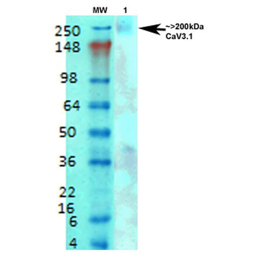 Western Blot analysis of Rat brain membrane lysate showing detection of Cav3.1 Calcium Channel protein using Mouse Anti-Cav3.1 Calcium Channel Monoclonal Antibody, Clone N178A/9 (STMA00120). Primary Antibody: Mouse Anti-Cav3.1 Calcium Channel Monoclonal Antibody (STMA00120) at 1:1000.