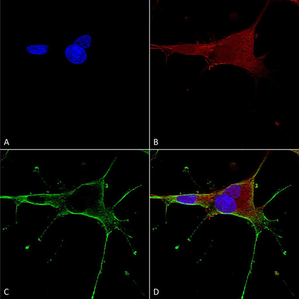 Immunocytochemistry/Immunofluorescence analysis using Mouse Anti-GluN1 Monoclonal Antibody, Clone N308/48 (STMA00124). Tissue: Neuroblastoma cells (SH-SY5Y). Species: Human. Fixation: 4% PFA for 15 min. Primary Antibody: Mouse Anti-GluN1 Monoclonal Antibody (STMA00124) at 1:50 for overnight at 4°C with slow rocking. Secondary Antibody: AlexaFluor 488 at 1:1000 for 1 hour at RT.