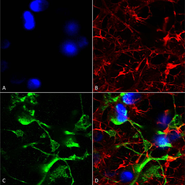 Immunocytochemistry/Immunofluorescence analysis using Mouse Anti-SUR2A Monoclonal Antibody, Clone N319A/14 (STMA00136). Tissue: Neuroblastoma cells (SH-SY5Y). Species: Human. Fixation: 4% PFA for 15 min. Primary Antibody: Mouse Anti-SUR2A Monoclonal Antibody (STMA00136) at 1:200 for overnight at 4°C with slow rocking. Secondary Antibody: AlexaFluor 488 at 1:1000 for 1 hour at RT.