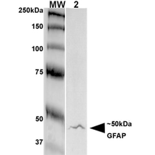 Western Blot analysis of Rat Brain Membrane showing detection of GFAP protein using Mouse Anti-GFAP Monoclonal Antibody, Clone N206A/8 (STMA00141). Primary Antibody: Mouse Anti-GFAP Monoclonal Antibody (STMA00141) at 1:250.