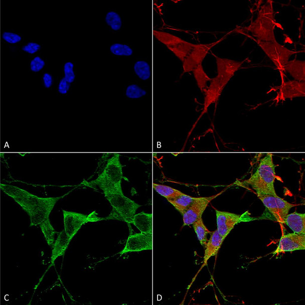 Immunocytochemistry/Immunofluorescence analysis using Mouse Anti-LAR/PTPRF Monoclonal Antibody, Clone N165/38 (STMA00143). Tissue: Neuroblastoma cells (SH-SY5Y). Species: Human. Fixation: 4% PFA for 15 min. Primary Antibody: Mouse Anti-LAR/PTPRF Monoclonal Antibody (STMA00143) at 1:100 for overnight at 4°C with slow rocking. Secondary Antibody: AlexaFluor 488 at 1:1000 for 1 hour at RT.