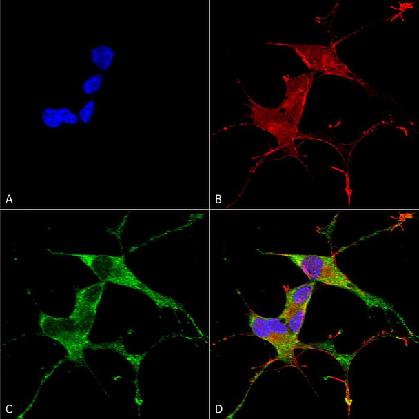 Immunocytochemistry/Immunofluorescence analysis using Mouse Anti-LRRK2/Dardarin Monoclonal Antibody, Clone N231B/34 (STMA00144). Tissue: Neuroblastoma cells (SH-SY5Y). Species: Human. Fixation: 4% PFA for 15 min. Primary Antibody: Mouse Anti-LRRK2/Dardarin Monoclonal Antibody (STMA00144) at 1:100 for overnight at 4°C with slow rocking. Secondary Antibody: AlexaFluor 488 at 1:1000 for 1 hour at RT.