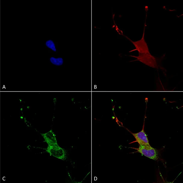 Immunocytochemistry/Immunofluorescence analysis using Mouse Anti-LGI1 Monoclonal Antibody, Clone N283/7 (STMA00154). Tissue: Neuroblastoma cells (SH-SY5Y). Species: Human. Fixation: 4% PFA for 15 min. Primary Antibody: Mouse Anti-LGI1 Monoclonal Antibody (STMA00154) at 1:100 for overnight at 4°C with slow rocking. Secondary Antibody: AlexaFluor 488 at 1:1000 for 1 hour at RT.