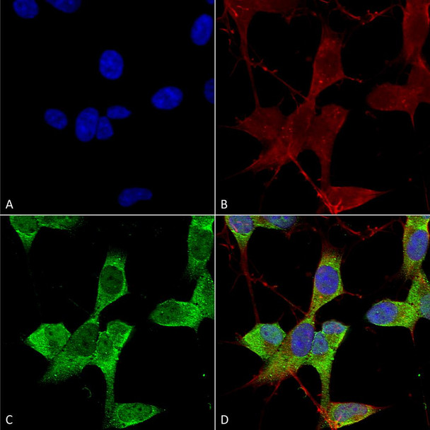 Immunocytochemistry/Immunofluorescence analysis using Mouse Anti-TASK1 Potassium Channel Monoclonal Antibody, Clone N374/48 (STMA00160). Tissue: Neuroblastoma cells (SH-SY5Y). Species: Human. Fixation: 4% PFA for 15 min. Primary Antibody: Mouse Anti-TASK1 Potassium Channel Monoclonal Antibody (STMA00160) at 1:50 for overnight at 4°C with slow rocking. Secondary Antibody: AlexaFluor 488 at 1:1000 for 1 hour at RT.